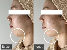 ベルフィーヌ 恵比寿店(BELFINE)/面長さん必見！(小顔/恵比寿)