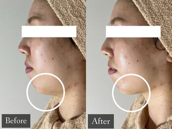 ベルフィーヌ 恵比寿店(BELFINE)/面長さん必見!(小顔/恵比寿)