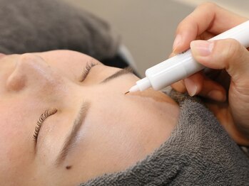 モルセラ(Moluccella)/施術風景