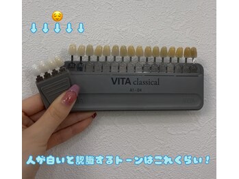 ルブラン 奈良店(Le Blanc)/歯のお色で印象は変わります！