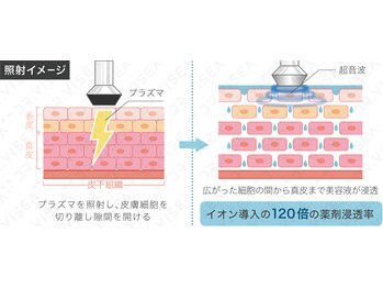 ミウ(MIU)/プラズマの効果