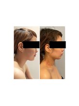 ルナグランデ 心斎橋店(Luna grande.)/横顔も劇的変化