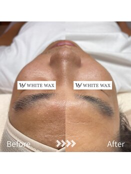 ホワイトワックス 浜松(WHITE WAX)/メンズこそワックスで清潔感を！