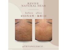 ナルフロウ(nalufurou)/ハーブピーリング