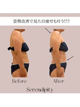 セレンディピティー(Serendipity)/【姿勢改善で下腹部もスッキリ】
