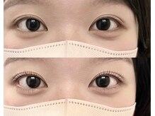 プライベートアイサロン オンリ(onri)/上下ラッシュリフト