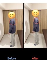 GWRいこい整体院/【巻き肩　Before After】