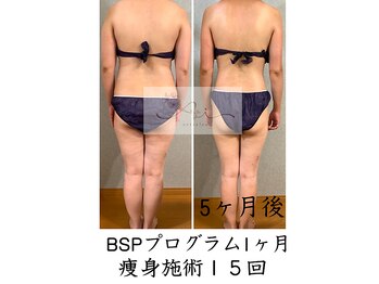 アイ エステサロン(Ai)/【40代】別人級ダイエット成功♪