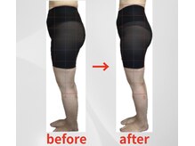 施術一回でも目に見える違いに感動のお声多数★