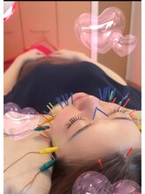 モッチ 天神大名店(MOCCHI)/10代の方でも！