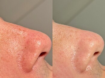 ルーナジェーナ(Luna llena)/