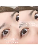 クレー(Klee)/ラッシュリフト