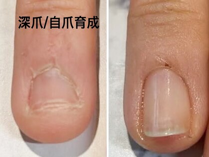 ネロリ(Neroli)の写真