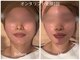 アムールドゥ 麻布十番(Amour deux)の写真