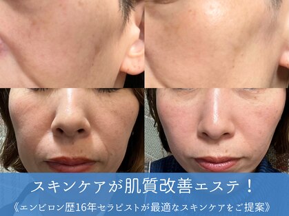 シュリー(Sriii)の写真