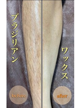 ジョアアンジェ 京橋店(joie ange)/夏はツルツルがモテる