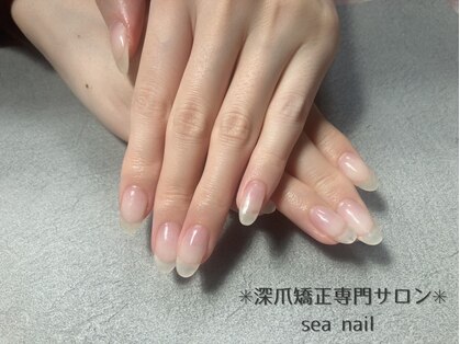 シーネイル(Sea nail)の写真