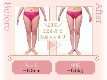 ピュアエステ ブリアント 新宿店/お客様の結果［新宿/痩身］