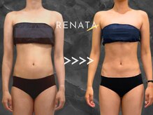 レナータ 大宮店(RENATA)/Before / After