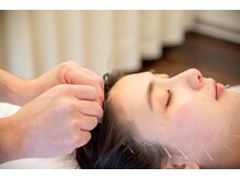 しらゆき堂鍼治療院/美容効果を高める頭皮の鍼