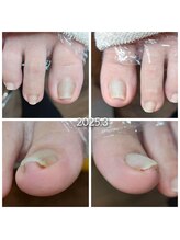 爪切り屋 足楽/