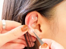 症状に合わせたツボにかわいい耳つぼジュエリーを貼っていきます