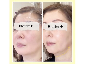 ボン セジュール(Bon sejour)/レモンボトル