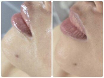 クレビア(CREBIA)/【シミ・シミケア専門店】沖縄県