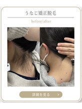 ミース 上野店/うなじデザインの実例