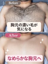 アルゴ 姪浜店(ALGO)&nbsp;ビフォー アフター