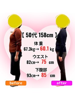 さらさ整骨院/ダイエット整体ビフォーアフター