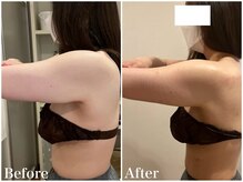 サロンドフェイス(Salon de Faith)/【ブライダル】3ヶ月施術♪