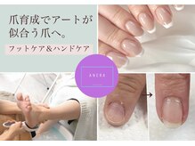 アネラ(ANERA)