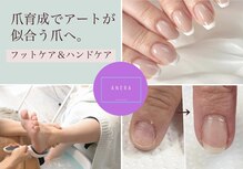アネラ(ANERA)
