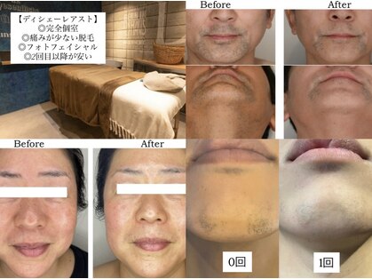 ディシェーレ アストの写真