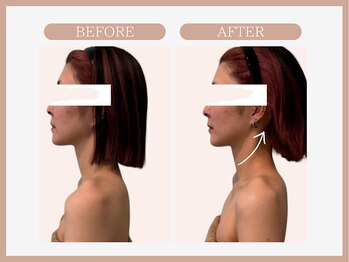 スリムライン 盛岡店(The Slim Line)/before→after