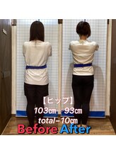 ヒデ整体院(Hide整体院)/ダイエット痩身成果＆骨盤矯正