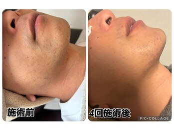 スリーアイ(THREE AI)/◆before→after◆