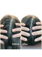 ニコディア(nico-dia)/小顔矯正