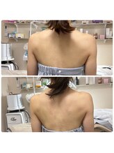 ルマエクレ(rmaecla)/細身のお客様もさらに細く