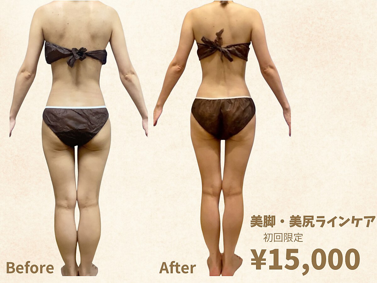 新宿区でEMSが人気のエステサロン｜ホットペッパービューティー