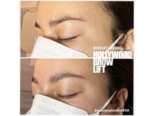 ディアビム(DiAViM)/＊ハリウッドブロウリフト＊