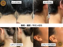 【業界最新THR脱毛マシン導入】ドア付き個室での丁寧な施術☆