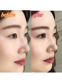 アイヨンマルゴ(EYE405)/LEDエクステ　パリエク