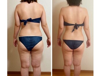 リュミエール(umiere)/【筋膜リリース】3ヶ月で変わる