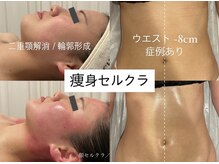 エクラ(eclat)の雰囲気（世界一痛い?!痩身セルクラ★結果がすぐ出るからリピ続出◎）