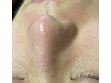 ビーカーブス 三鷹(B.curves)/汚れスッキリ！