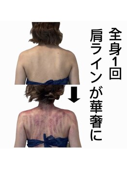 スピード美人 新宿店/スライドカッピング全身1回