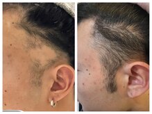 ケイナイン(K-9)/頭皮で悩んでいる方