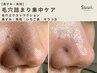 【黒ずみ・角栓集中】いちご鼻に◎毛穴エクストラクション80分